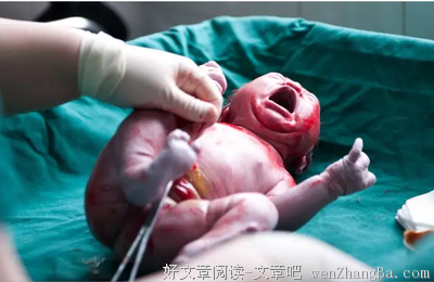 100张剖腹产过程照片（看完泪奔）不论男女都应该看看！