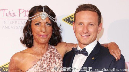 怀个孕轰动了全世界？只因她老公是全球最帅的男人
