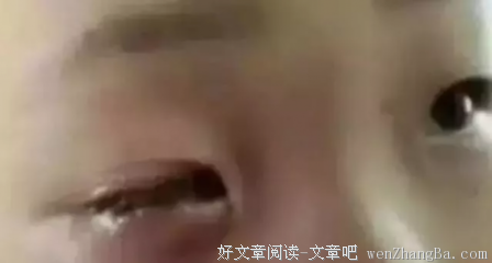 【可怕】20分钟孩子眼珠被溶化！这东西你家也有