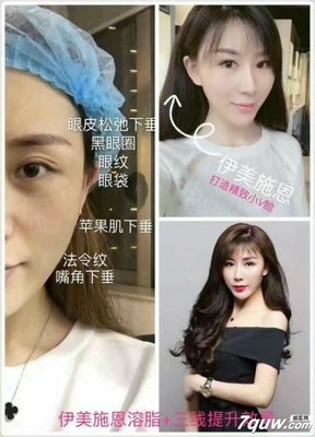 做做减法，过一个松弛的2018