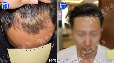 重塑你的过去和未来