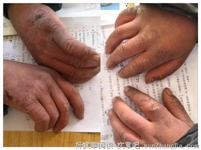 “冰花男孩”戳痛所有人：你没资格抱怨，更没理由堕落！
