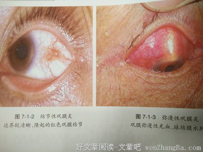 认识你真好：热情与理想的矛盾，访问陈怡安医师（2）（上）