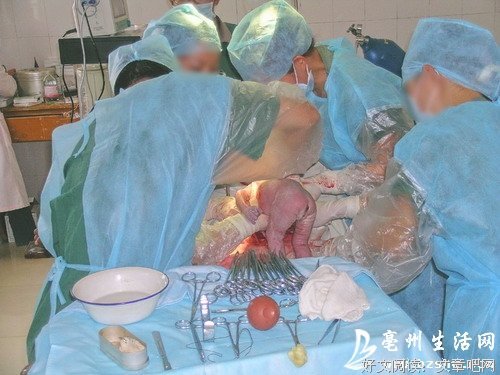 “我老婆是生孩子的工具，不需要麻醉剂”