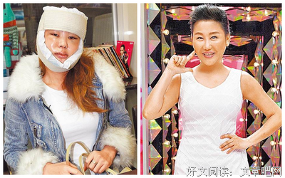 她14岁开始整容，花费超400万：“我的脸上是一栋楼”