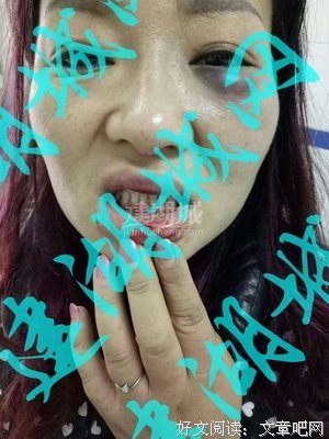 前夫打得我遍体鳞伤，我卖了他一辆车作为补偿，他疯狂骂我家人