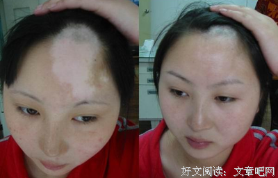 久治不愈的句子