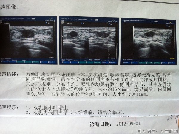 “ 恋爱2年，被男朋友气出乳腺纤维瘤 ”
