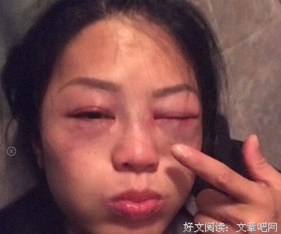 一种玩笑丨玩不死你算我输