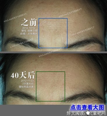 《皱纹》好看吗？经典影评10篇