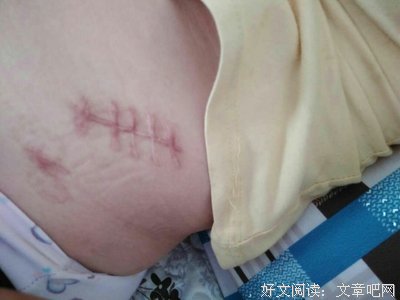 冒险生一胎、意外怀二胎的惊喜之旅 | 真人书NO.2