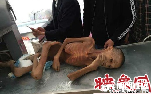 描写皮包骨头的语句摘抄