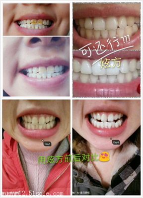 微笑的你，如此美丽