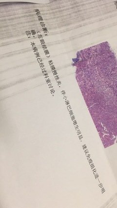 为什么我们需要惩罚