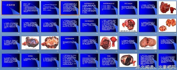 恶性肿瘤的名句_关于恶性肿瘤的名句