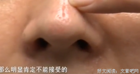 “用男朋友的肋骨做鼻子，分手后要还吗？”