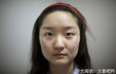 是什么阻止了姑娘去整容？