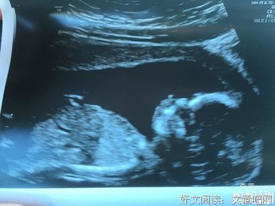 “怀着别人的孩子嫁给了老公”