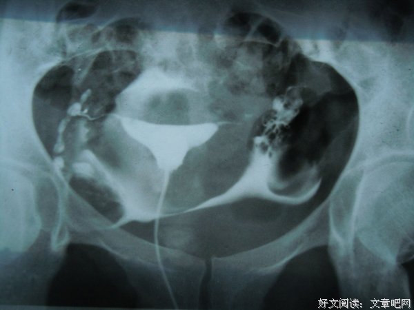 实录｜一心求子的我，不孕的病根居然在婆婆