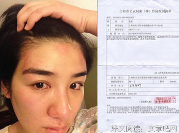 “丈夫打断我3根肋骨，孩子护着我哀求恸哭。”