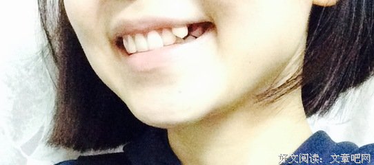 又有吃播把牙吃断了！也太可怕了吧！