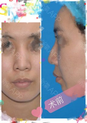 《你耳软骨发炎了》好段摘抄大全