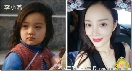 今昔