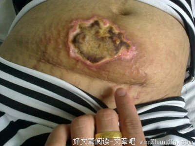 问药