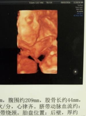 父亲一直在我身边