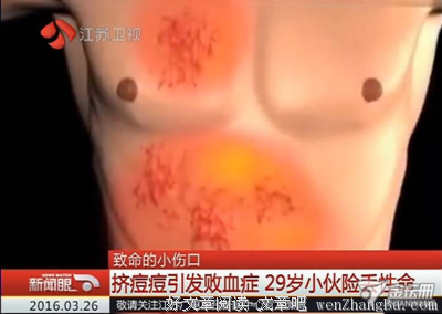  一颗肺的历程
