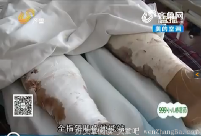 意外的收割