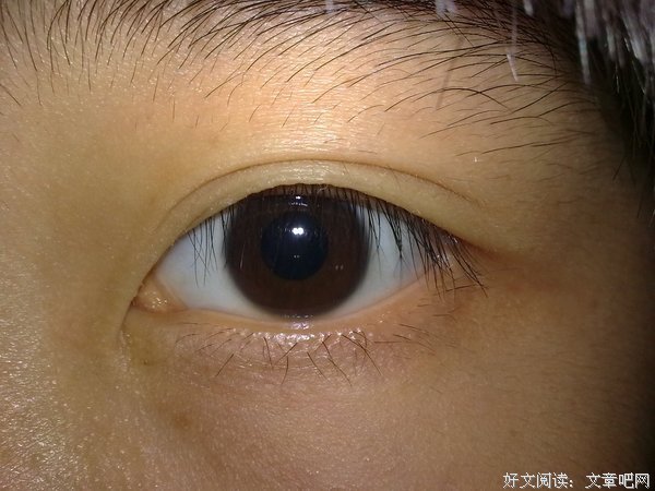 眼睛
