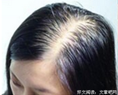 失去了最好的
