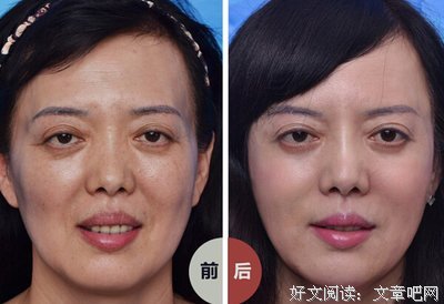 将“酸”进行到底