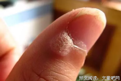 这个冬季很长
