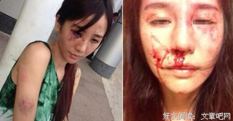 被家暴逼疯的女人
