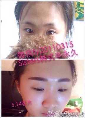 十年，与病儿握手前行 l 程果儿