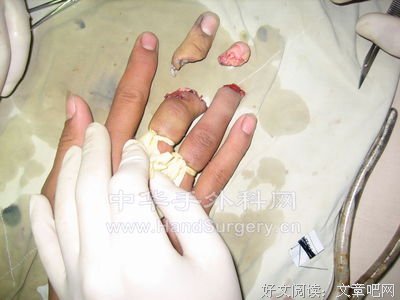 最全的《疯狂修复》经典的句子