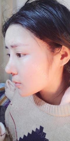 最全的《你耳软骨发炎了》佳句摘抄