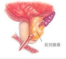 倾诉 