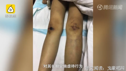 我爸成了植物人后，后妈跑了