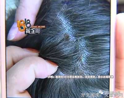 我拒绝宣传女医生剃光头