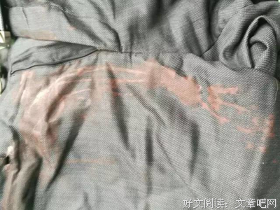 医生自曝ICU惊险日常：“抢救时，家属带刀站在我身后”