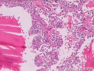 被人说甲状腺有问题后，我特意去体检了一下……