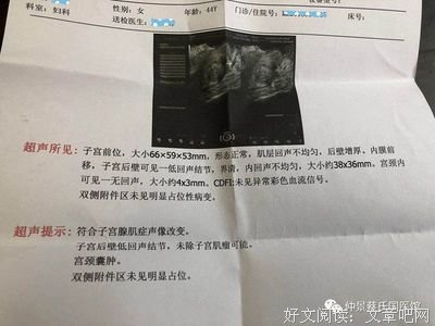 子宫腺肌症“三多”：经量多血块多疼痛多，告诉你怎么来改善它？