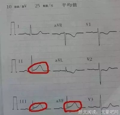 《人其实有两条命》读后感精选