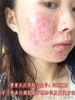 鲤·荷尔蒙读后感摘抄
