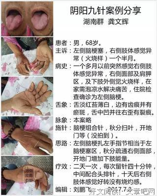 秋风一起，关节受罪！贴了睡一觉，舒服又灵活