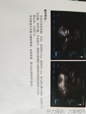 叔：生了女儿后，老公拿苹果砸我的头