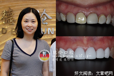 这套科学的牙齿美白方法，让你的笑容更加自信
